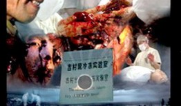 黑太阳在线观看